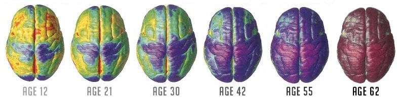 brain changes as we age
